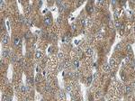 MMP11 Antibody in Immunohistochemistry (Paraffin) (IHC (P))