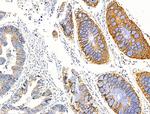 PCAF Antibody in Immunohistochemistry (Paraffin) (IHC (P))