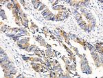 PCAF Antibody in Immunohistochemistry (Paraffin) (IHC (P))