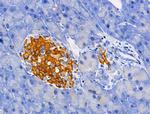 PCAF Antibody in Immunohistochemistry (Paraffin) (IHC (P))