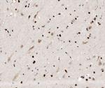 HYD Antibody in Immunohistochemistry (Paraffin) (IHC (P))