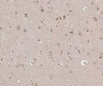 TRADD Antibody in Immunohistochemistry (Paraffin) (IHC (P))