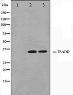 TRADD Antibody in Western Blot (WB)