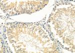 GAK Antibody in Immunohistochemistry (Paraffin) (IHC (P))