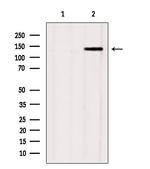 GAK Antibody in Western Blot (WB)