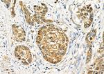 TRIM24 Antibody in Immunohistochemistry (Paraffin) (IHC (P))