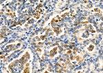 TRIM24 Antibody in Immunohistochemistry (Paraffin) (IHC (P))