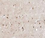 ZIC1/ZIC2/ZIC3 Antibody in Immunohistochemistry (Paraffin) (IHC (P))