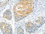 ZIC1/ZIC2/ZIC3 Antibody in Immunohistochemistry (Paraffin) (IHC (P))