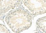 LMX1B Antibody in Immunohistochemistry (Paraffin) (IHC (P))