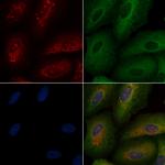 Thrombin Antibody in Immunocytochemistry (ICC/IF)