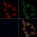 ABCF1 Antibody in Immunocytochemistry (ICC/IF)