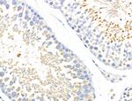 ABCF1 Antibody in Immunohistochemistry (Paraffin) (IHC (P))