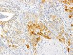 ABCF1 Antibody in Immunohistochemistry (Paraffin) (IHC (P))