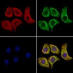 PTPN22 Antibody in Immunocytochemistry (ICC/IF)