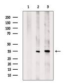 AGPAT9 Antibody in Western Blot (WB)