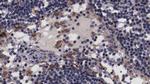 NT5C3A Antibody in Immunohistochemistry (Paraffin) (IHC (P))