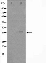 NT5C3A Antibody in Western Blot (WB)