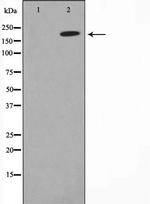 MAGI2 Antibody in Western Blot (WB)