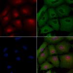 Lass4 Antibody in Immunocytochemistry (ICC/IF)