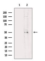 FKRP Antibody in Western Blot (WB)