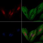 IRX2 Antibody in Immunocytochemistry (ICC/IF)