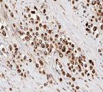 IRX2 Antibody in Immunohistochemistry (Paraffin) (IHC (P))