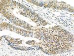 IRX2 Antibody in Immunohistochemistry (Paraffin) (IHC (P))