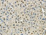 IRX2 Antibody in Immunohistochemistry (Paraffin) (IHC (P))