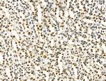 IRX2 Antibody in Immunohistochemistry (Paraffin) (IHC (P))