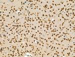 IRX2 Antibody in Immunohistochemistry (Paraffin) (IHC (P))