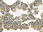 IRX2 Antibody in Immunohistochemistry (Paraffin) (IHC (P))