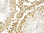 IRX2 Antibody in Immunohistochemistry (Paraffin) (IHC (P))