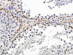 PIAS1 Antibody in Immunohistochemistry (Paraffin) (IHC (P))