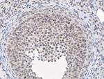 PIAS1 Antibody in Immunohistochemistry (Paraffin) (IHC (P))