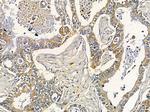 DMPK Antibody in Immunohistochemistry (Paraffin) (IHC (P))