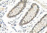 EGR1 Antibody in Immunohistochemistry (Paraffin) (IHC (P))