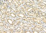 EGR1 Antibody in Immunohistochemistry (Paraffin) (IHC (P))