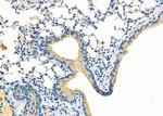 CYP2B6 Antibody in Immunohistochemistry (Paraffin) (IHC (P))