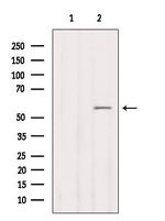 CYP2B6 Antibody in Western Blot (WB)