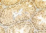 ERGIC3 Antibody in Immunohistochemistry (Paraffin) (IHC (P))