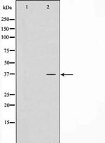 CTU1 Antibody in Western Blot (WB)