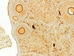 FAP Antibody in Immunohistochemistry (Paraffin) (IHC (P))