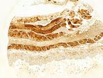 FAP Antibody in Immunohistochemistry (Paraffin) (IHC (P))