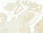 FAP Antibody in Immunohistochemistry (Paraffin) (IHC (P))