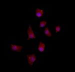 CtBP1 Antibody in Immunocytochemistry (ICC/IF)