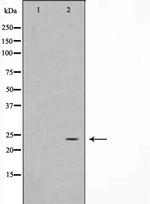 PPP1R2 Antibody in Western Blot (WB)