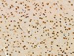 Phospho-CtBP1 (Ser422) Antibody in Immunohistochemistry (Paraffin) (IHC (P))