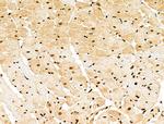 Phospho-CtBP1 (Ser422) Antibody in Immunohistochemistry (Paraffin) (IHC (P))