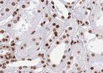 Phospho-CtBP1 (Ser422) Antibody in Immunohistochemistry (Paraffin) (IHC (P))